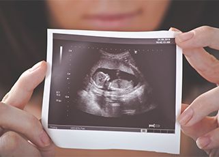 mother-holding-ultrasound-picture